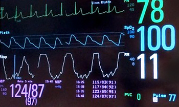 Vital Signs Monitor